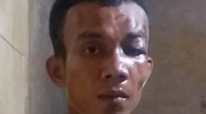 Jambret Bonyok