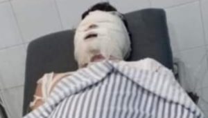 Korban Rampok Dibakar