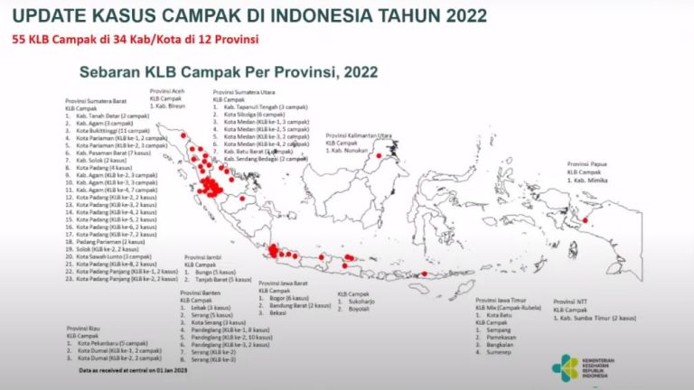 KLB Campak