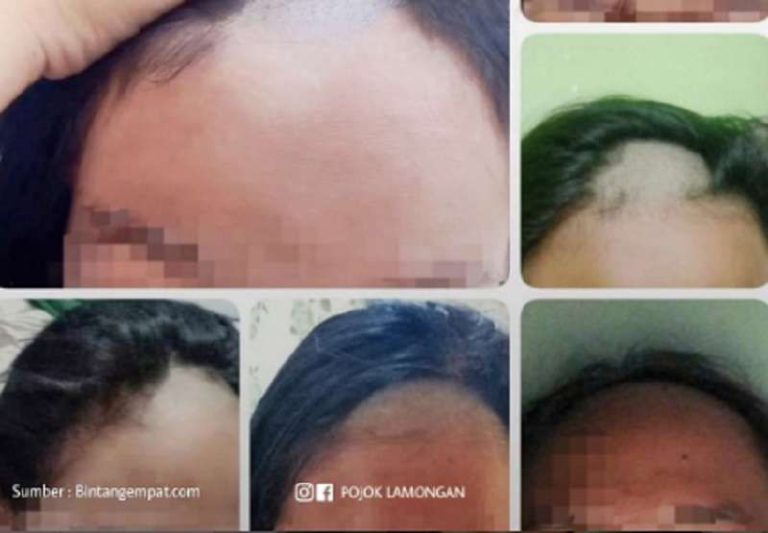 Penggundulan Siswi