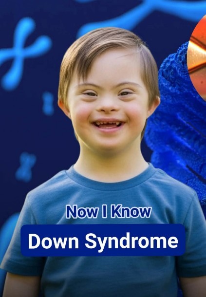 Down Syndrome
